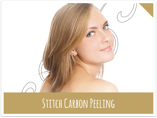 Stitch Mainz Carbon Peeling